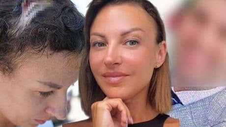 Uzaklaştırma kararı sonrası vahşet! Kafatasına zımba atıldı, elleri kırıldı: Plan yapıp beni öldürmeye geldi