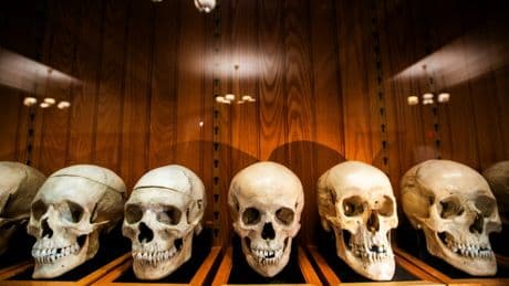 Etats-Unis : exposer des restes humains, le Mütter Museum de Philadelphie entre éthique et pédagogie