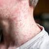 Doctors issue urgent warning after world's most infectious disease kills child in Liverpool - more deaths 'a tragic inevitablity'