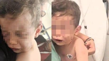 2 yaşındaki bebek annesinin erkek arkadaşı tarafından öldüresiye dövüldü