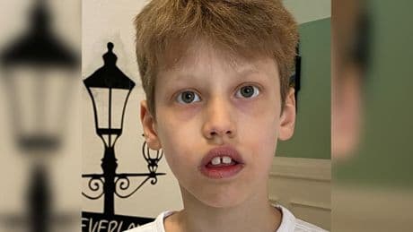 Polizei sucht ihn mit Foto - Autistischer Junge (10) spurlos verschwunden