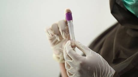 Botulino: cos’è, sintomi, rischi e cure dell’intossicazione alimentare più pericolosa