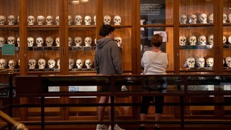 Medical museum in Philadelphia overhauls policies on human remains to meet modern ethical standards