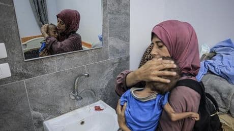 Hunger in Gaza: Das Kind aus Gaza, über das die Welt spricht
