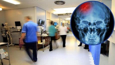 Why do so many Scots die from a stroke?