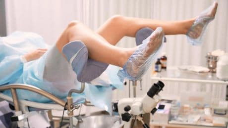 ¿Qué es la conización cuando se tiene el Virus del Papiloma Humano?