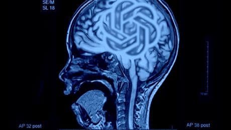 El gran robo de cerebros de la IA y cómo las universidades pueden contrarrestarlo