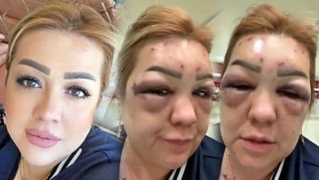Herkes şiddet mağduru zannetti, gerçek çok başka çıktı! 'Mağdurum' diyerek video çekip yaşadıklarını anlattı