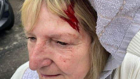 'Blood everywhere' after vicious seagull attack as Scots woman rushed to hospital