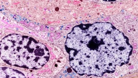 Diabète de type 1 : pourquoi les médecins se prennent à rêver de guérison