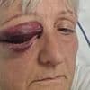 Grandmother suffers fractured skull, bruising and a bleed on the brain after being run down by cyclist in front of her six-year-old grandchild