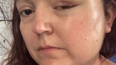 'I was told my symptoms were perimenopause - then I had a seizure'