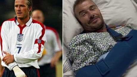 How David Beckham suffered injury in England match that's led to surgery 22 years later