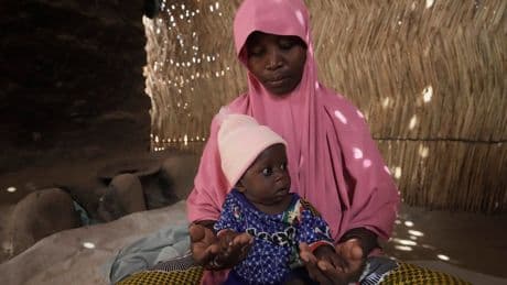 Children die as USAID aid cuts snap a lifeline for the world's most malnourished