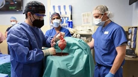 La edad dorada de los trasplantes de órganos: "Hemos hecho rutinario algo de ciencia ficción"