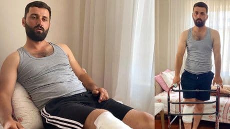 Arkadaşı kürekle vurdu, ayı saldırısından kurtuldu