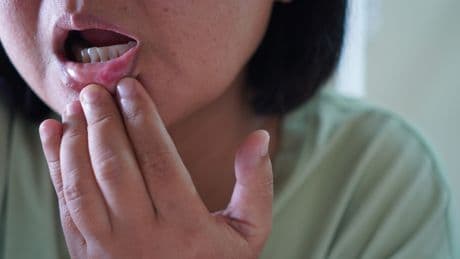 Mundkrebs: Diese Symptome sollten Sie nicht ignorieren