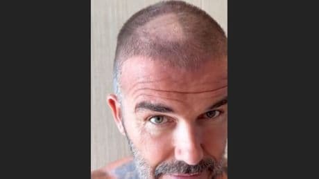 Trend oder Trash? - Beckham zeigt sich mit DIESER wilden Frisur