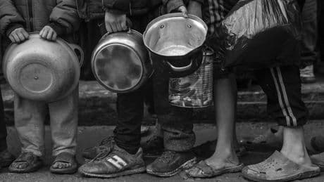 Ausgehungertes oder krankes Kind? Wie Journalisten den Hunger in Gaza verhöhnen