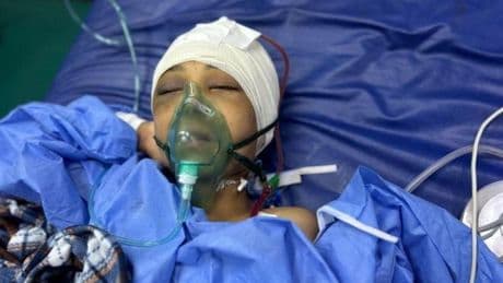 Doctores internacionales en Gaza: "Estamos en shock por la cantidadde niños quetratamos"