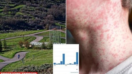 Thousands of people exposed to measles at major sporting event as infections spread