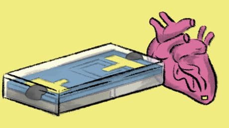 Des chercheurs mettent au point un pacemaker miniature et biorésorbable