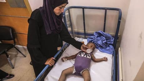 On y est, les enfants gazaouis meurent de faim sous les yeux de médecins impuissants