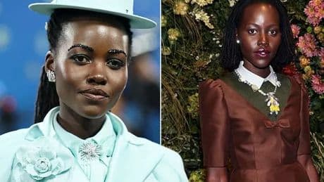 Lupita Nyong'o reveals secret decade-long health battle in candid post