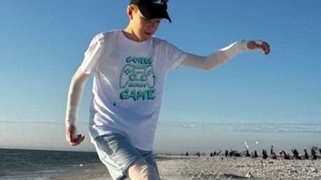 Boy, 12, with rare genetic skin disorder can now play football after breakthrough medical trial
