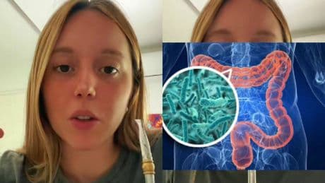 Lucía, médica residente: "Los probióticos están de moda, pero si no los acompaño de una buena alimentación pasan como unos turistas por el intestino"