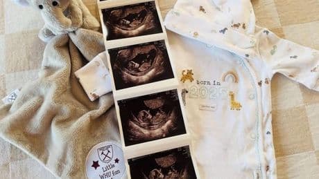 Bake Off winner announces adorable baby news as Alison Hammond sends sweet message