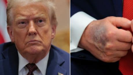 America is split on whether Trump’s health and age are impacting his ability to serve as president