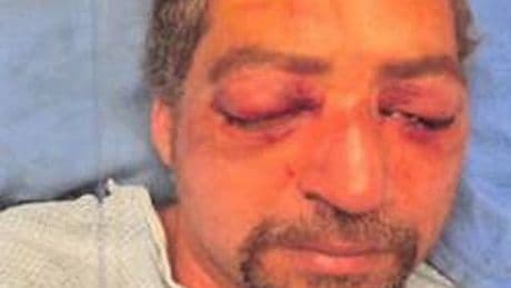 Man recalls horrifying 'pop' as road rage driver 'used thumbs to gouge eyes out'