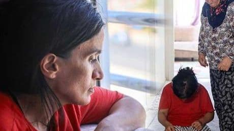 Hastalığı yüzünden evden çıkamıyor, 6 saat banyoda kalıyor! ‘Arkadaşlarım benimle alay ediyor’