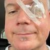 I went blind in one eye because the NHS 'forgot' to offer me tests that could have saved my sight