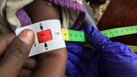 Kampf gegen den Hunger: Fortschritte gegen den Hunger - aber nicht überall