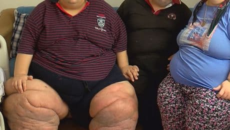 270 kiloya ulaştı! "15 aydır evden çıkamıyorum, yardım edin"