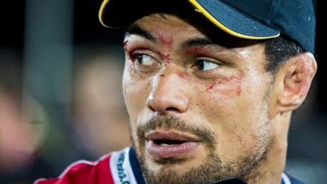 Ex-rugby player Shane Christie, who called for study of concussion, dies at age 39