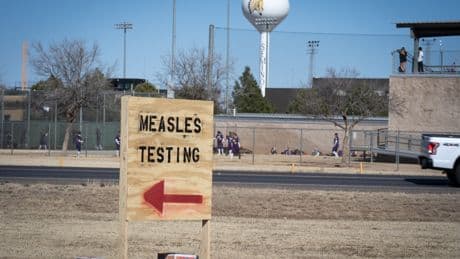 4 charts reveal just how bad the measles outbreak has gotten