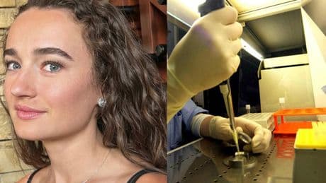 Glioma: cosa è, sintomi, cause e mortalità della malattia che ha ucciso l'attrice Kelley Mack