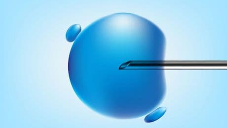 Ocho bebés nacen sin una enfermedad hereditaria gracias a la donación de ADN
