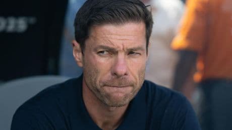Now We Wil See If Xabi Alonso Is Worthy Of Real Madrid