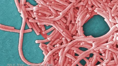 Ontario food manufacturer’s cooling tower likely source of deadly legionnaires’ outbreak