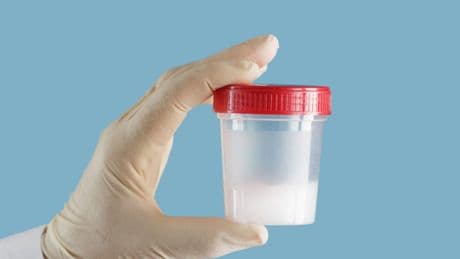 Donatori instancabili, leggi fragili: così l’Europa insegue il “super sperm donor»