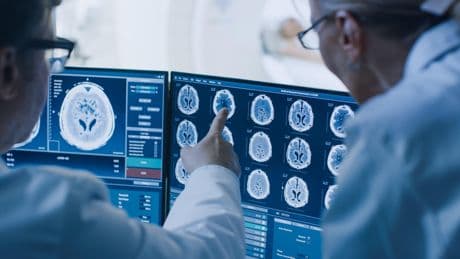 Dépression résistante : un traitement par ultrasons testé avec succès