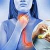 How to heal heartburn WITHOUT drugs: Acid reflux pills taken by millions cause crippling side-effects and are even linked to cancer and dementia. Now doctors reveal what to do