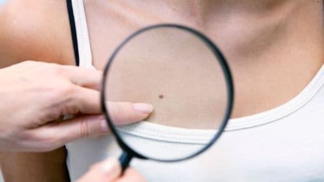 Medizin: Geht ein Hautarzt in die Drogerie