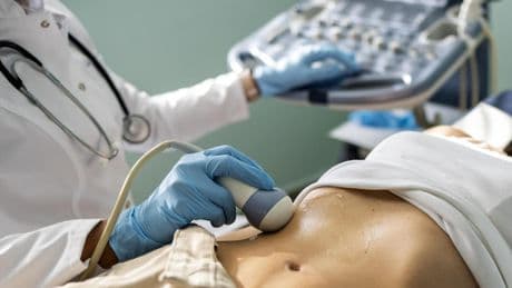 El cáncer olvidado que se ha cuadruplicado en 40 años: la preocupante escalada de los tumores de apéndice
