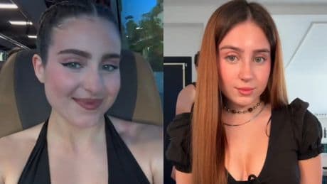 RoRo Bueno sorprende a sus seguidores con un nuevo retoque estético: el antes y después de su rinoplastia