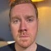 'I was lucky to survive a one-punch attack'